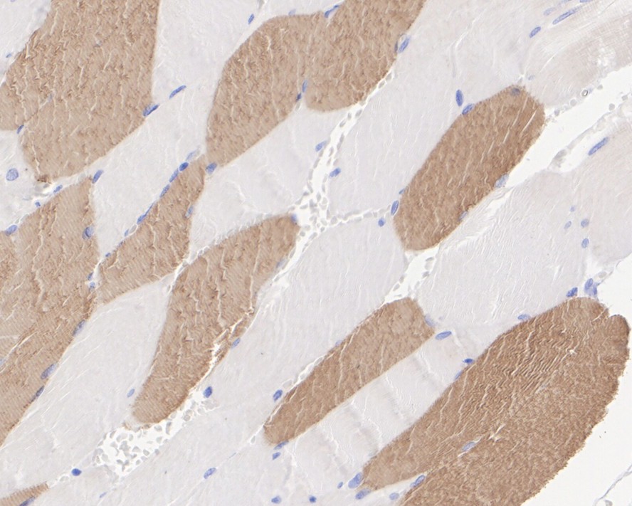 Myosin Heavy Chain Rabbit Monoclonal Antibody(ARA910)