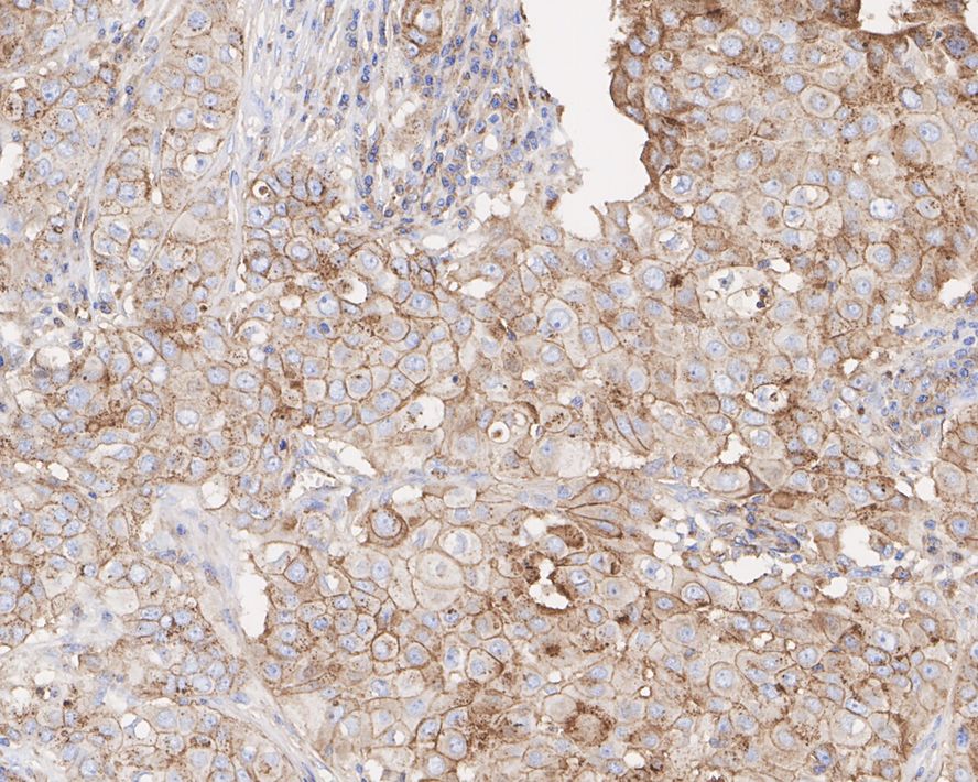 ESA Rabbit Monoclonal Antibody(ARA917)