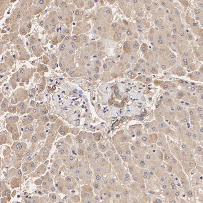 LXR alpha Rabbit Monoclonal Antibody(ARA934)