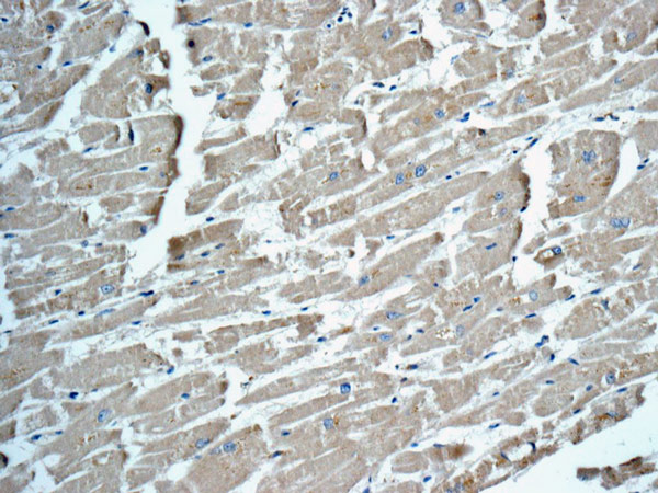 CYP11B2 Rabbit Monoclonal Antibody(ARA927)
