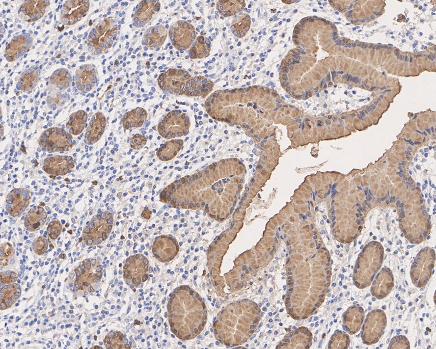 pS2 Rabbit Monoclonal Antibody(ARA923)