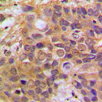 DAXX Rabbit Polyclonal Antibody
