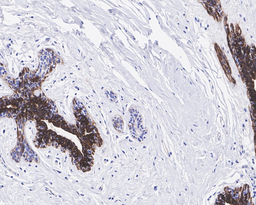Cytokeratin 5&6 Rabbit Monoclonal Antibody(ARA943)