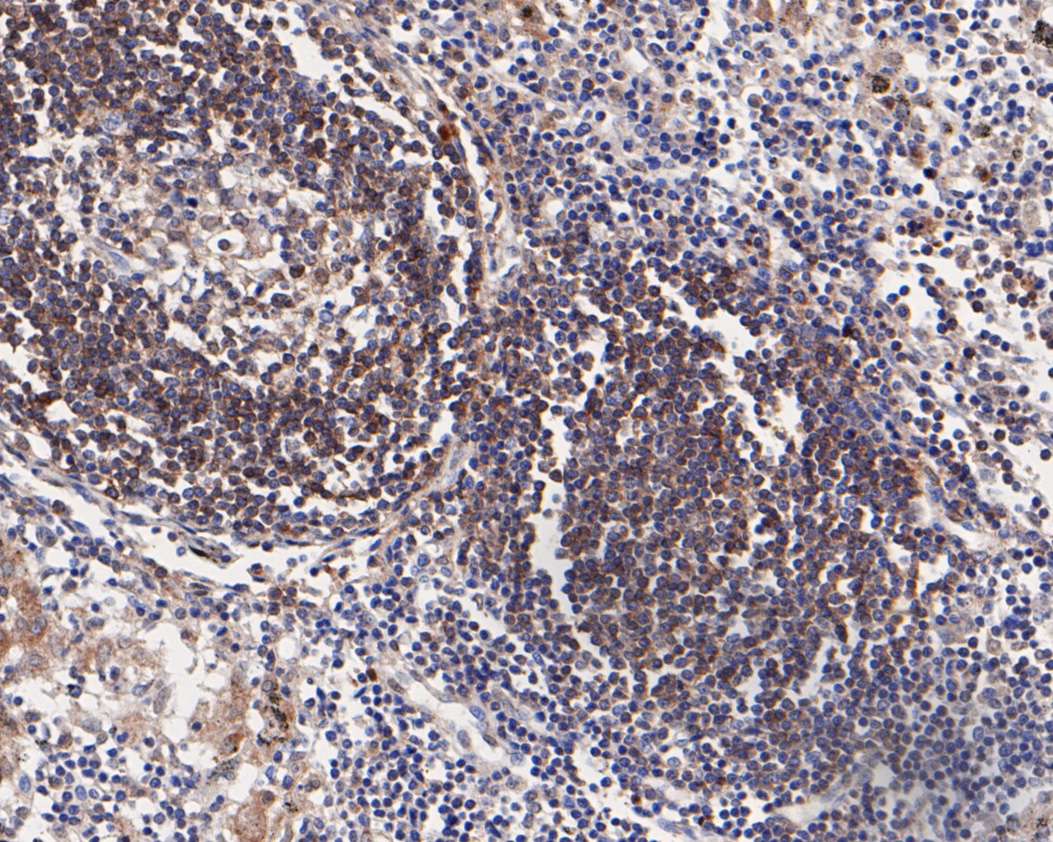 CD79b Rabbit Monoclonal Antibody(ARA939)