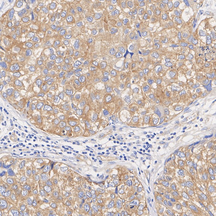 FGFR3 Rabbit Monoclonal Antibody(ARA915)