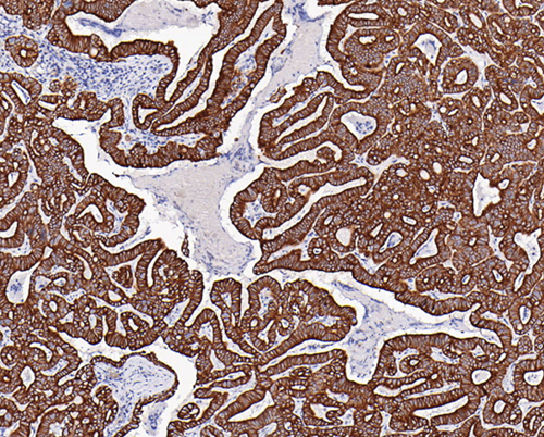 CK(LMW) Mouse Monoclonal Antibody(ARA953)