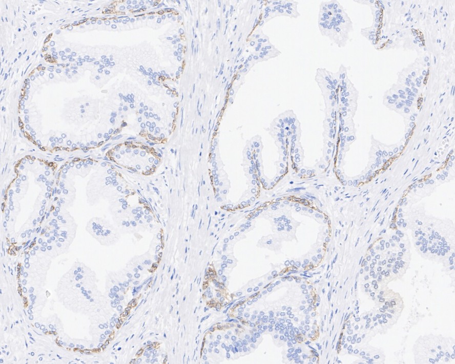 TRIM29 Rabbit Monoclonal Antibody(ARA963)