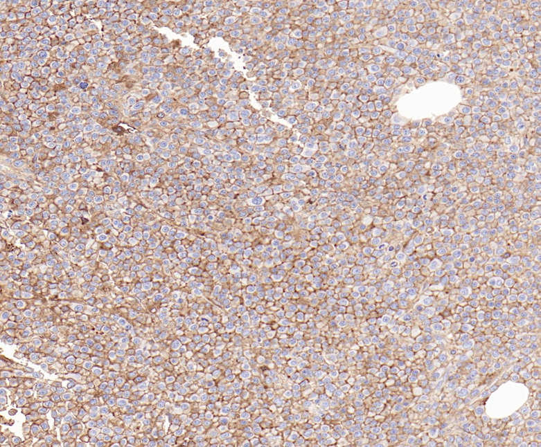 CD138 Rabbit Monoclonal Antibody(ARB586)