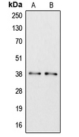 Apolipoprotein L6 Rabbit Polyclonal  Antibody