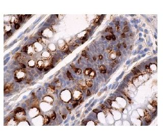 p300 Mouse Monoclonal Antibody (F-4)