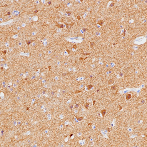 Pan-TRK Rabbit Monoclonal Antibody(ARB518)