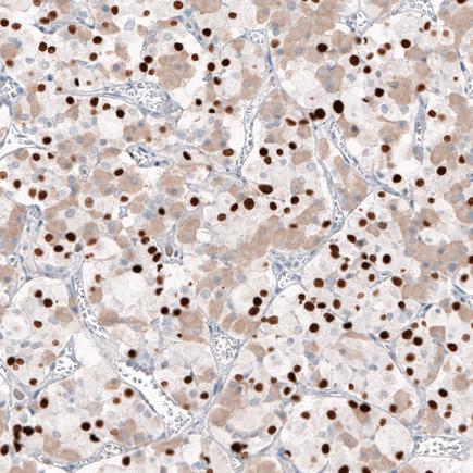 Tpit Mouse Monoclonal Antibody(ARA846)