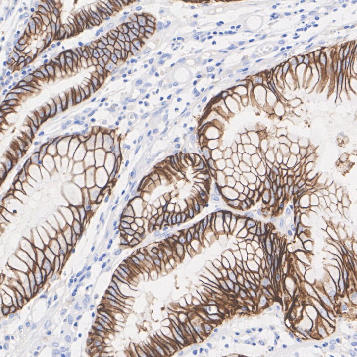Claudin 18.2 Mouse Monoclonal Antibody(ARA848)