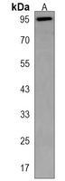 NCX3/SLC8A3 Rabbit Polyclonal Antibody