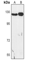 SREBP-1c Rabbit Polyclonal Antibody