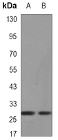 XBP1 Rabbit Monoclonal Antibody(ARA844)