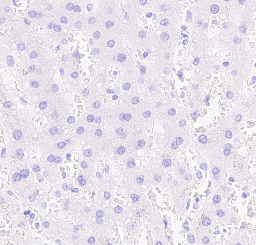 Pit1 Rabbit Monoclonal Antibody(ARA847)