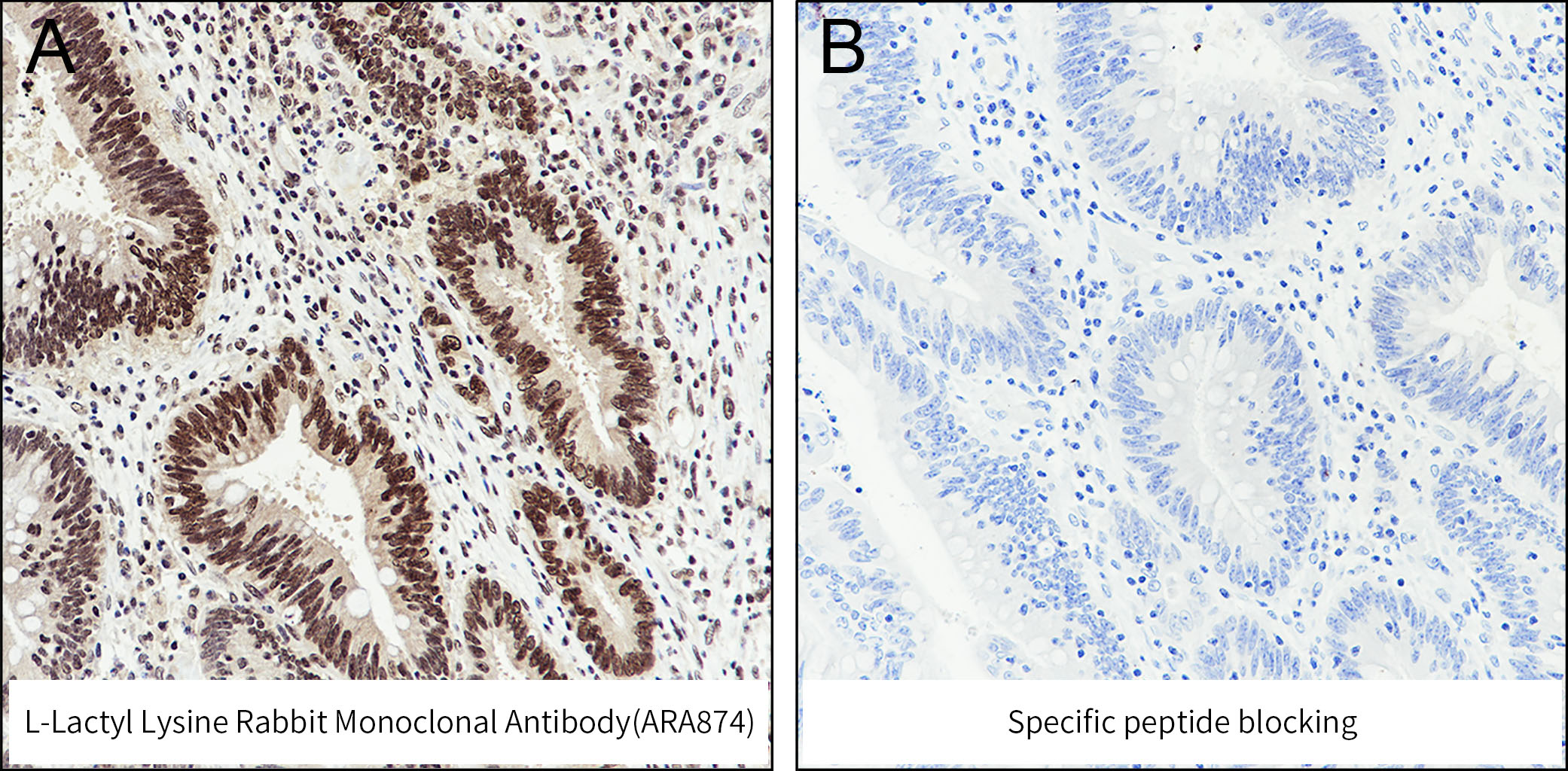 L-Lactyl Lysine Rabbit Monoclonal Antibody(ARA874)