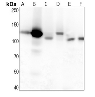 CD51 Rabbit Monoclonal Antibody(ARA877)