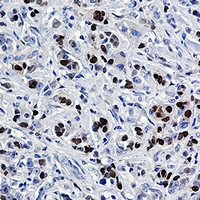 SOX9 Rabbit Monoclonal Antibody(ARA876)
