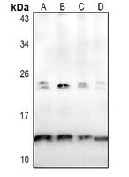 Osteocalcin Rabbit Polyclonal Antibody