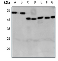 CRHR2 Rabbit Polyclonal Antibody