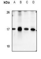 S100A7 Rabbit Polyclonal Antibody