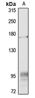 ABCB4/MDR3 Rabbit Polyclonal Antibody