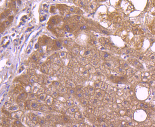 TAPA1/CD81 Rabbit Monoclonal Antibody(ARA961)