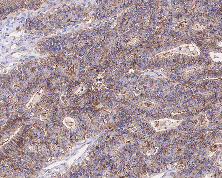 CD9 Rabbit Monoclonal Antibody(ARA959)
