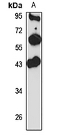 C1GALT1 Rabbit Polyclonal Antibody