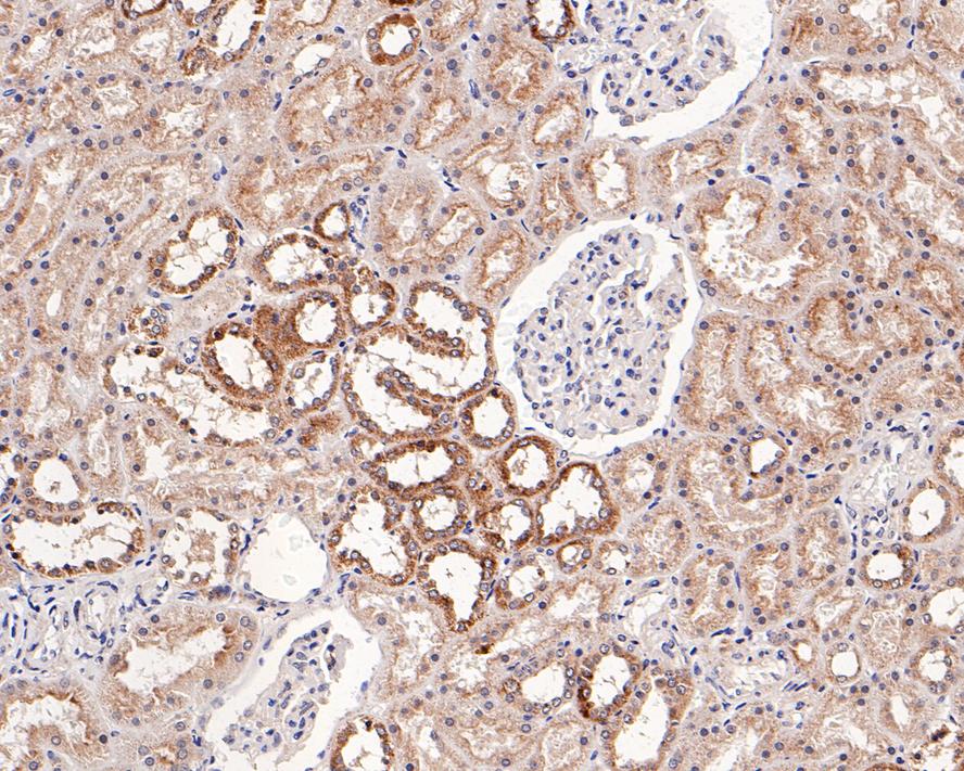 TSG101 Rabbit Monoclonal Antibody