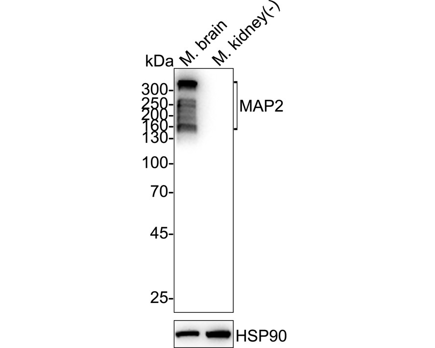 MAP2 Rabbit Monoclonal Antibody(ARA965)