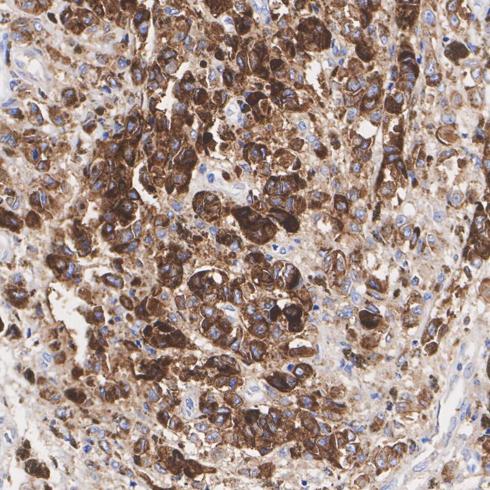 CD63 Rabbit Monoclonal Antibody(ARA960)