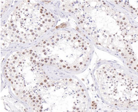 EZH2 Rabbit Monoclonal Antibody(ARB951)