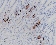 Gastrin Rabbit Monoclonal Antibody(ARB956)