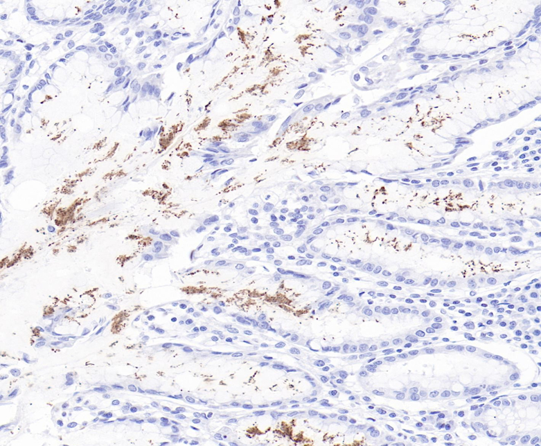 Helicobactor pylori Rabbit Monoclonal Antibody(ARB587)