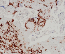 HLA-G Rabbit Monoclonal Antibody(ARB969)