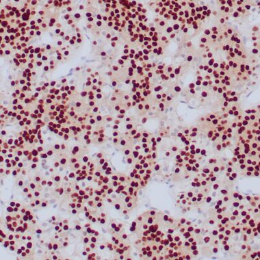 PIT-1/POU1F1 Rabbit Monoclonal Antibody(ARA967)