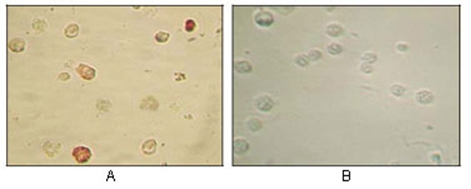 HHV-8 Mouse Monoclonal Antibody(ARA968)