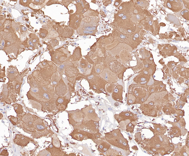 Tyrosine Hydroxylase Rabbit Monoclonal Antibody(ARB577)