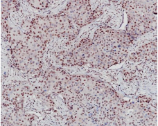 E2F4 Rabbit Monoclonal Antibody(ARB944)