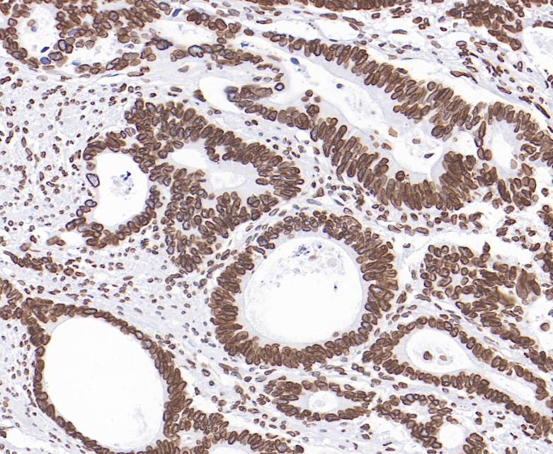 Lamin B1 Rabbit Monoclonal Antibody(ARB582)