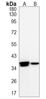 Cathepsin K Rabbit Monoclonal Antibody(ARA875)