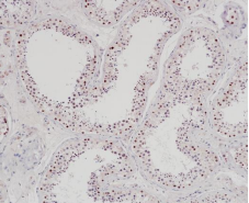 EZHIP Rabbit Monoclonal Antibody(ARB952)