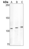 RB1 Rabbit Monoclonal Antibody(ARA831)