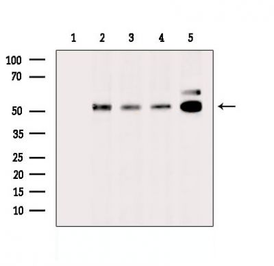 MINDY1 Rabbit Polyclonal Antibody