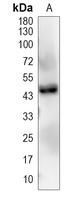POU2F3 Rabbit Polyclonal Antibody