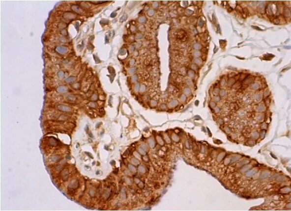 SC Mouse Monoclonal Antibody(ARA987)