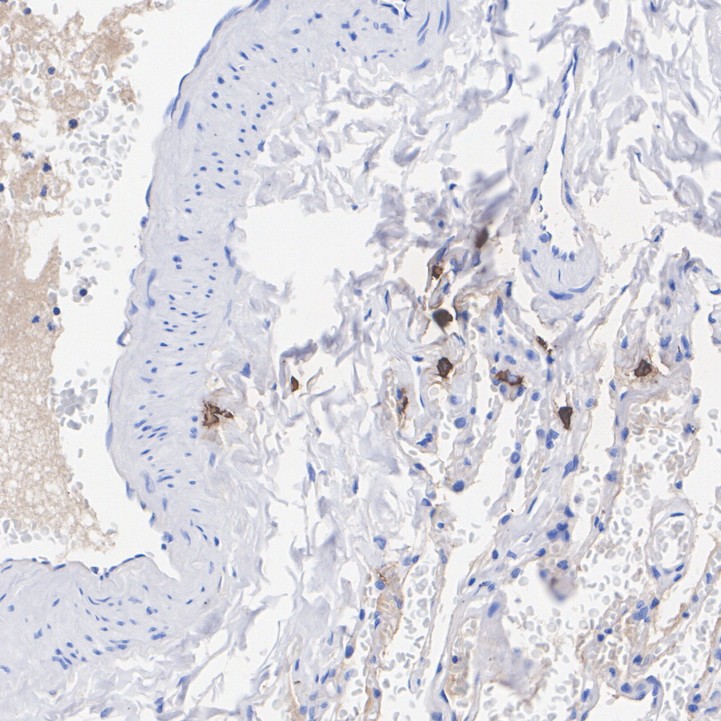 Mast Cell Tryptase Rabbit Monoclonal Antibody(ARA833)